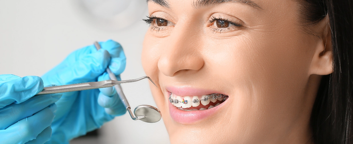 Ortodoncia con alineadores transparentes Invisalign